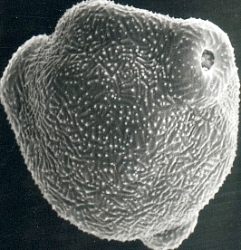 Pollen de Bouleau, Serge Muller